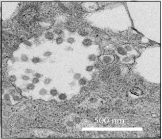 2019 ncov zhou et al nature 2020