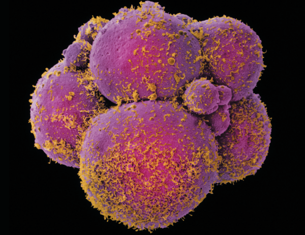 Embryon humain au stade 8 cellules