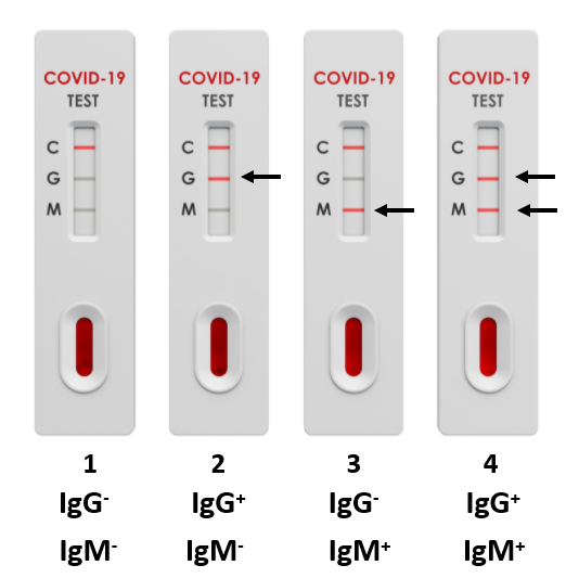 Lecture tests serologique