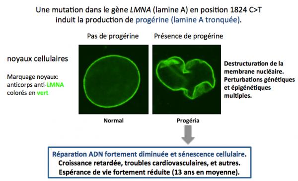 Progeria 2